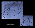 bordetella pertussis